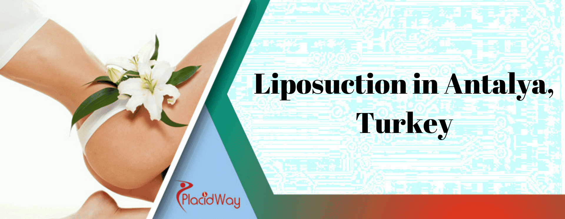 What are the Top 10 Questions You Should Ask a Plastic Surgeon before Going for Liposuction in Antalya, Turkey?